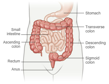 ulcerative-colitus-abdomen-IBS