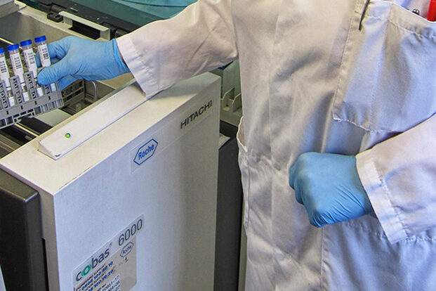 Pamela_Bowe_FCAL_turbo Loading fCAL turbo faecal calprotectin tests onto the cobas 6000